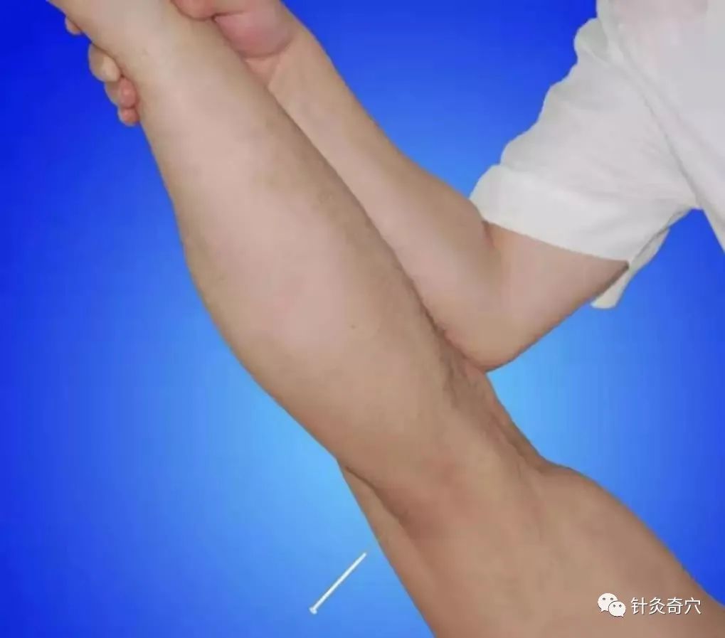 史上最全中医针灸视频教程全集,针灸治疗真实图片大全