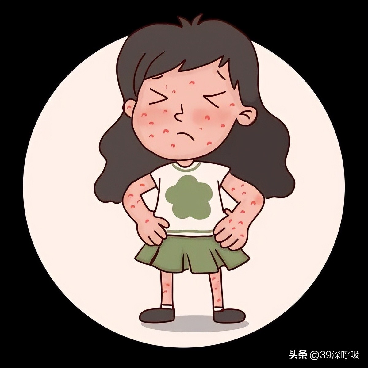 成人布洛芬过敏吃什么替代退烧药,容易过敏的人吃什么退烧药