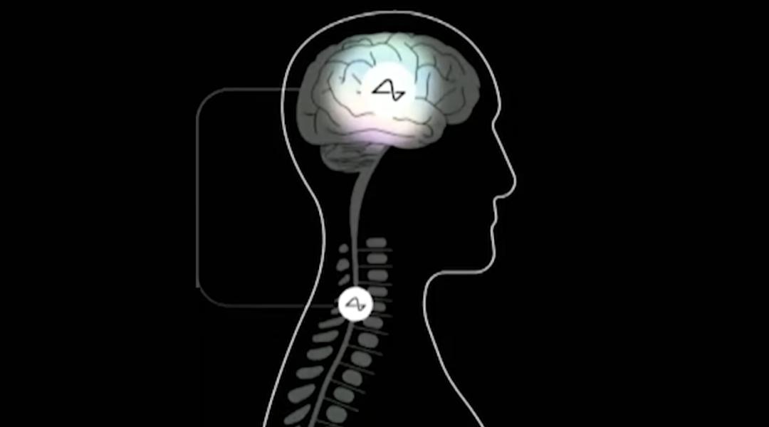 猴子看猩球崛起,猴子通过脑机接口进食