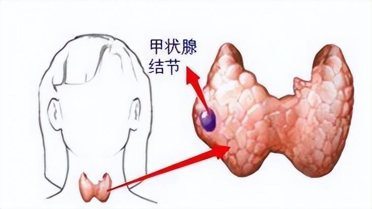 这4种病无需过度治疗,这几种病千万别过度治疗