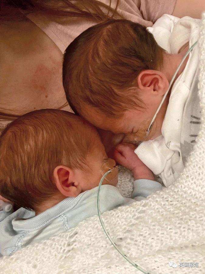 女子双子宫同时怀胎,双子宫妇女怀孕的几率有多少