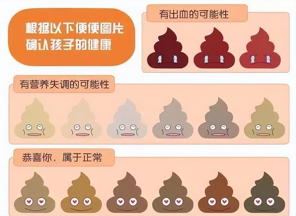 看大便怎么样辨别疾病,大便臭预示三种疾病