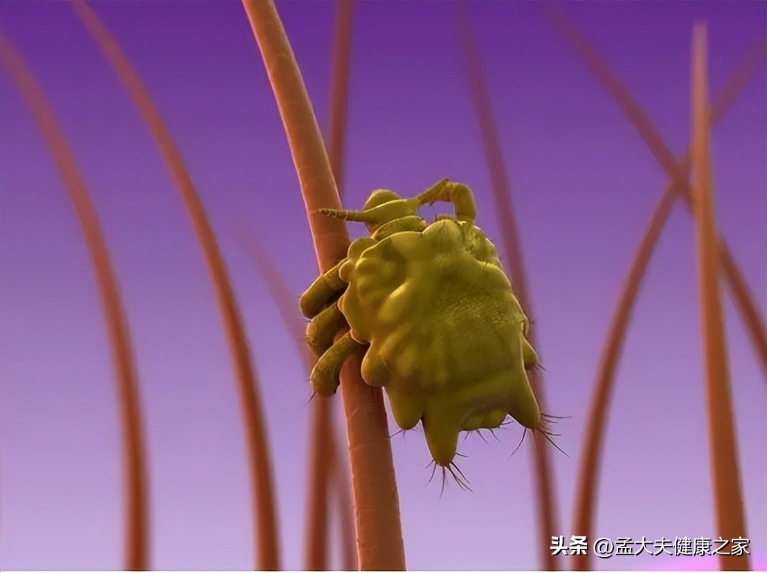 男性大量阴虱和虫卵,男子腹痛夹出8条活虫