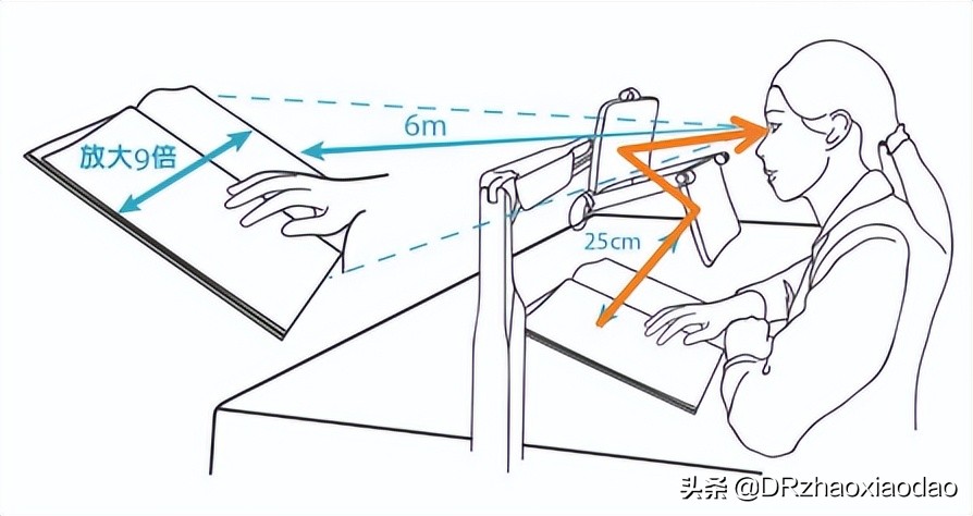 雾视治疗的最佳方法,雾视治疗是什么意思