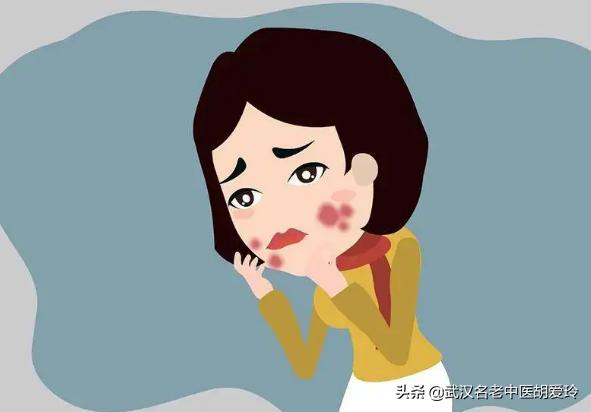 脸上特别干燥起皮屑怎么办,脸上头上干燥起皮屑抹什么药好