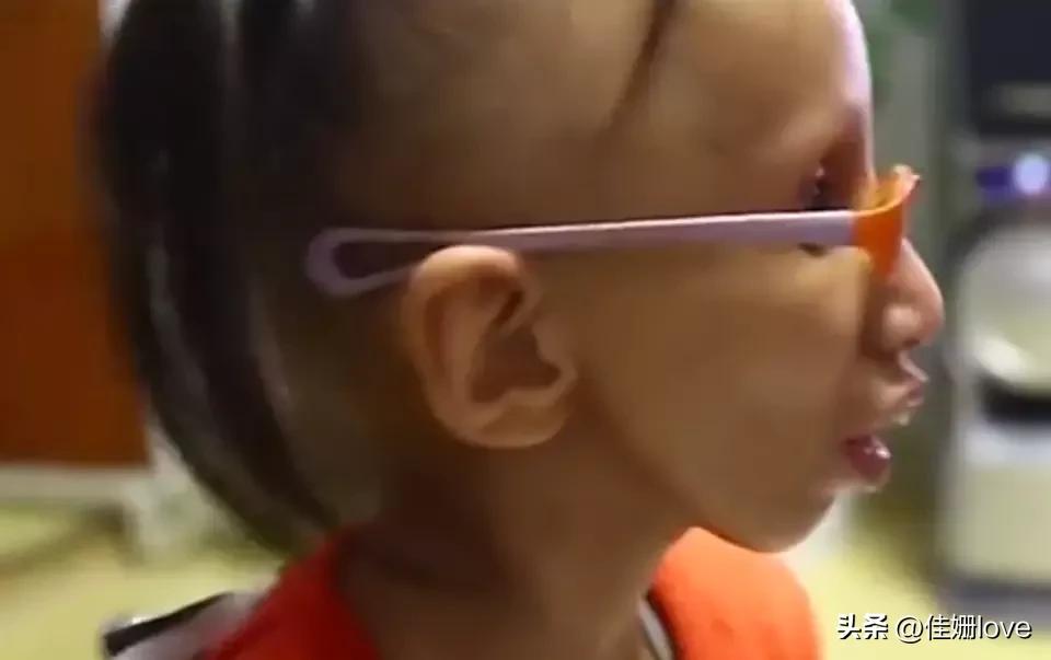14岁女孩拥有80多岁的容貌，生命的尽头是希望妈妈生个弟弟