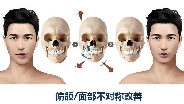 怎样改善左右脸不对称,怎样改善大小脸不对称呢
