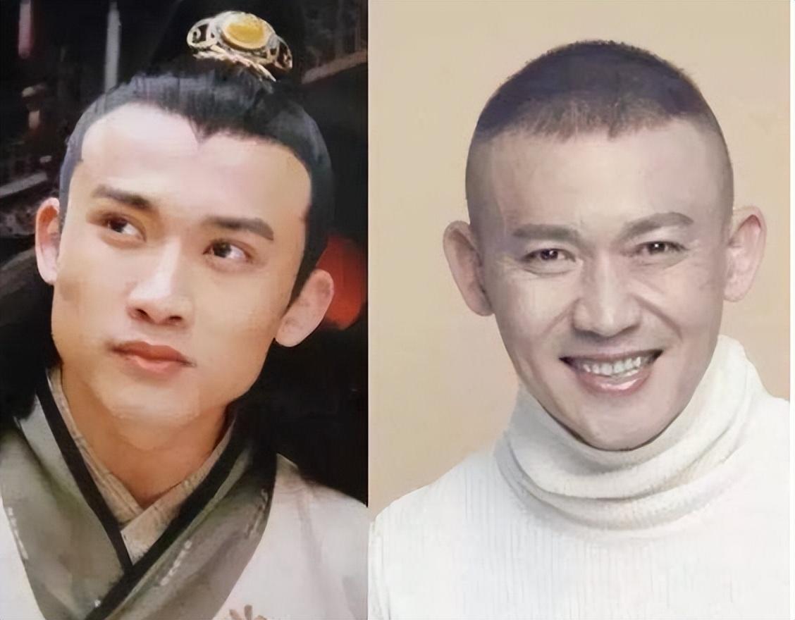 娱乐圈的整容脸,为什么娱乐圈那么多整容脸