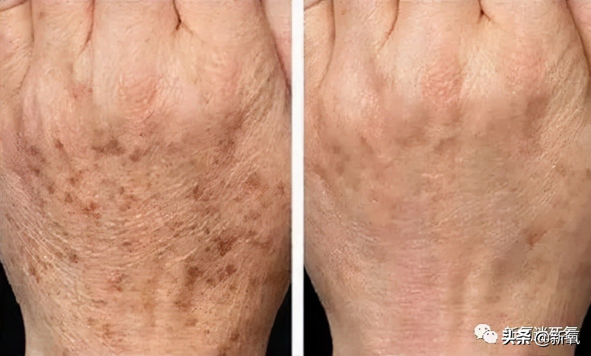 一个人变老的四种表现,一个人的年龄在脸上能不能看出来