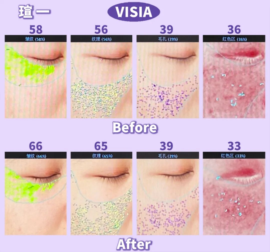 美肌抗老,城野医生169抗老精华测评