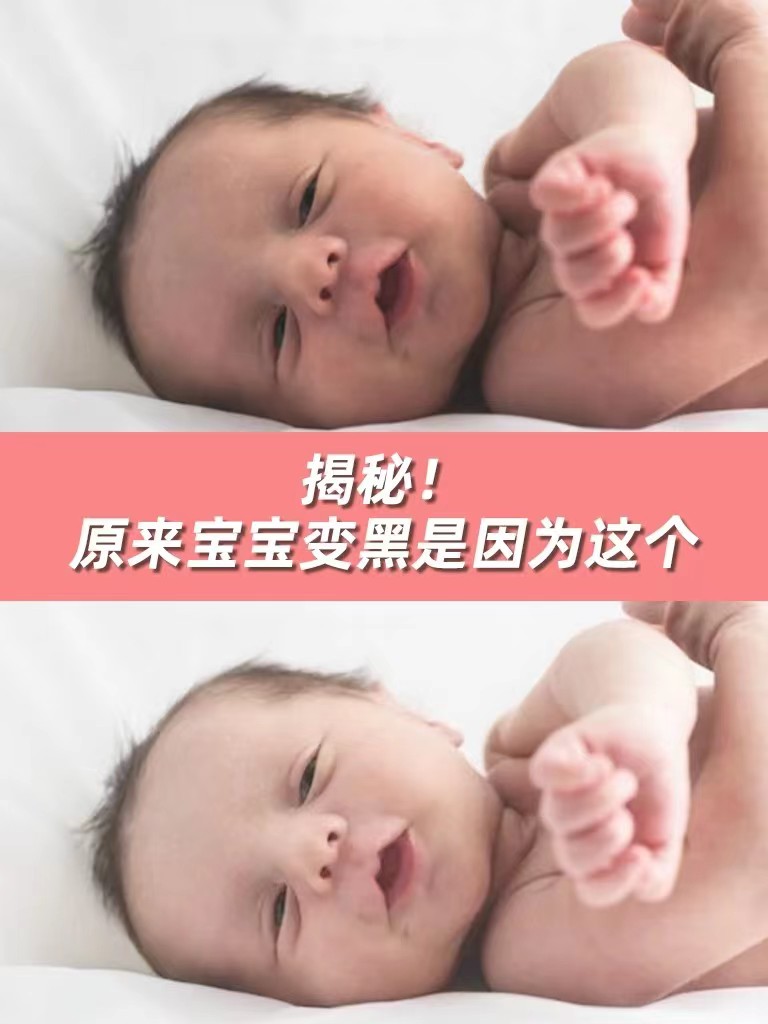 宝宝面霜黑脸成分大揭秘，宝宝皮肤变黑原来是这样，宝妈快自查