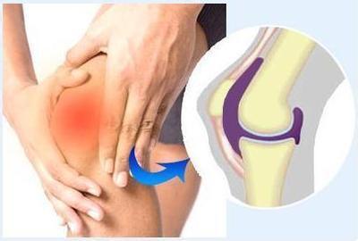 孩子现在得了滑膜炎怎么治疗,儿童得了滑膜炎怎么回事