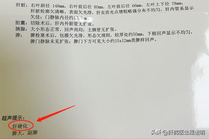 最新治乙肝方法,泥鳅粉治乙肝案例