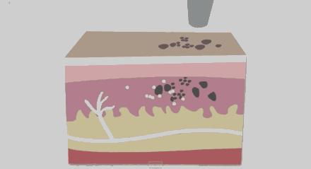 洗纹身科普,科普知识洗纹身