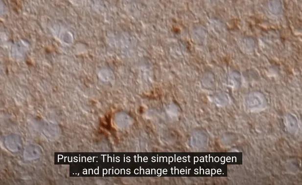 笑病的病因,笑能治病的真实原因