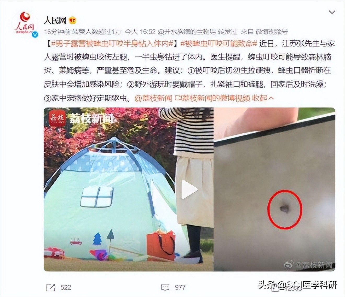 男子户外踏青被蜱虫叮咬高烧不止,男子被蜱虫叮咬住进icu