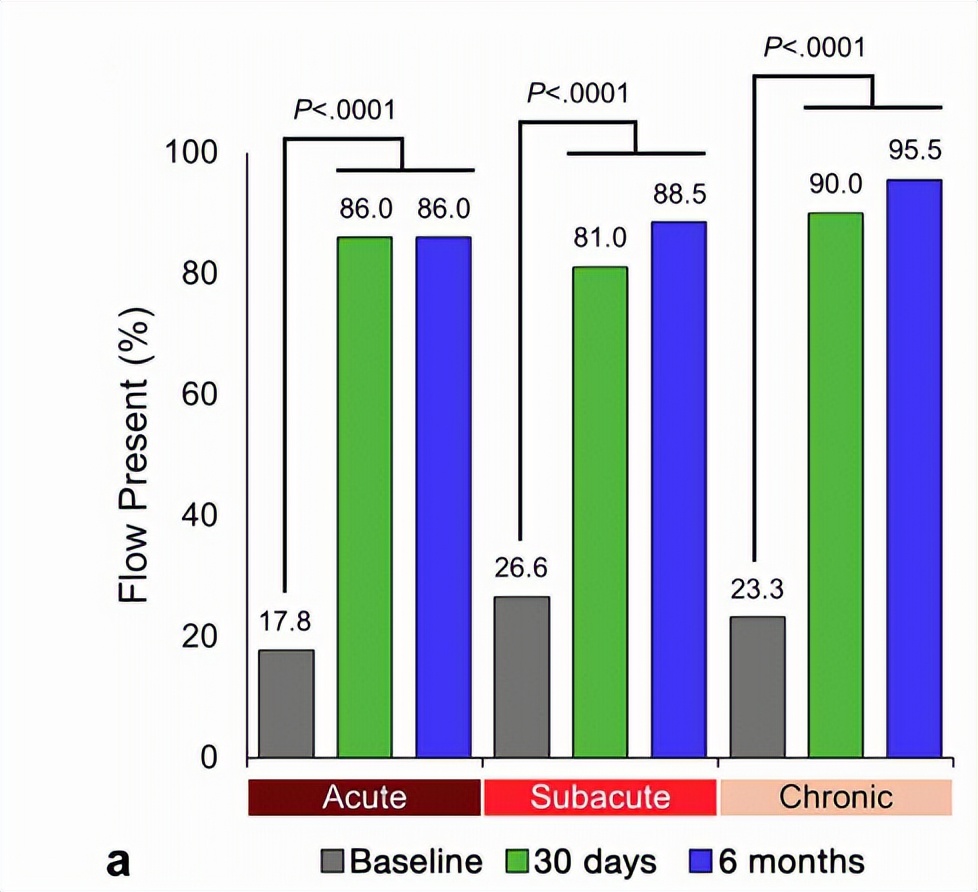 下肢静脉血栓介入全过程,深静脉血栓的一体化治疗