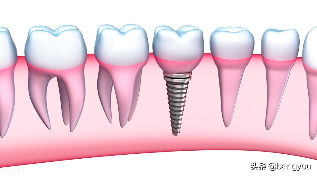 减缓衰老的小技巧,延缓衰老的5个小秘诀