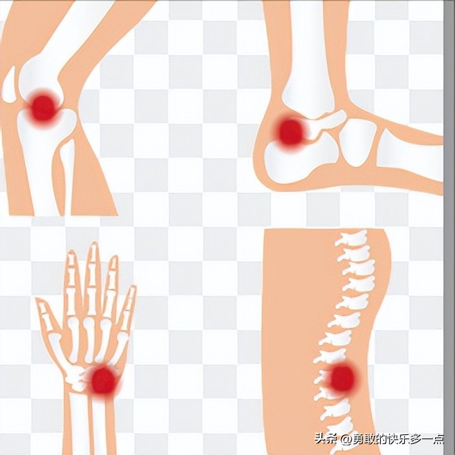 撕脱骨折后遗症,什么是撕脱骨折