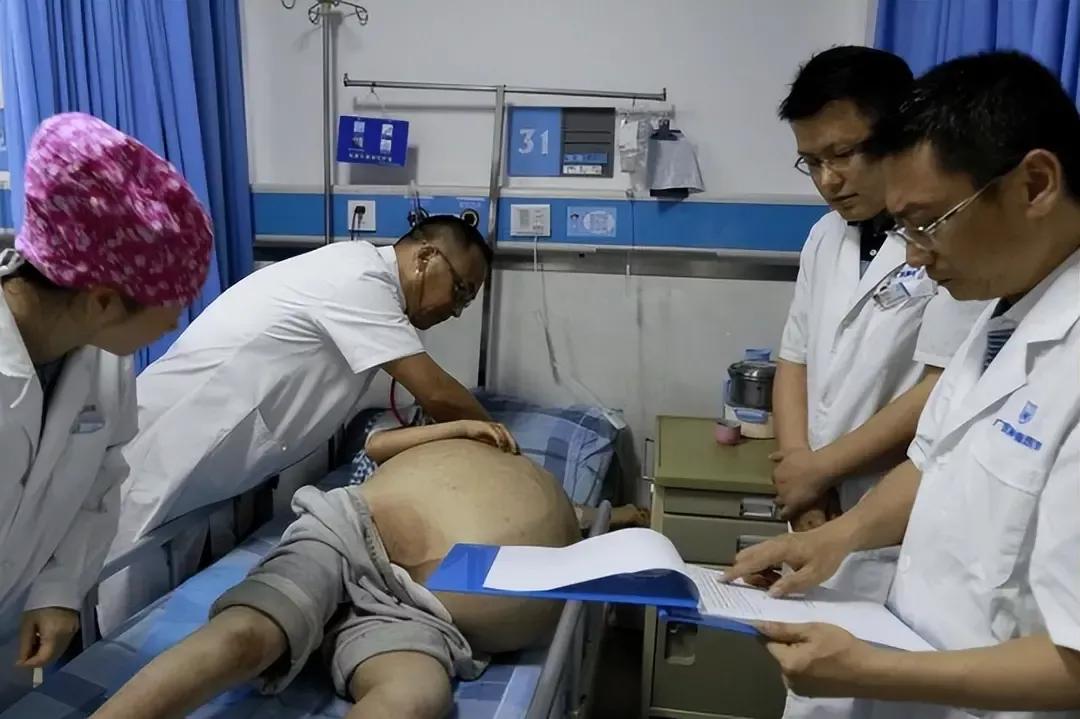 被高压枪充气的13岁男孩现状,山东男孩被高压气打入身体