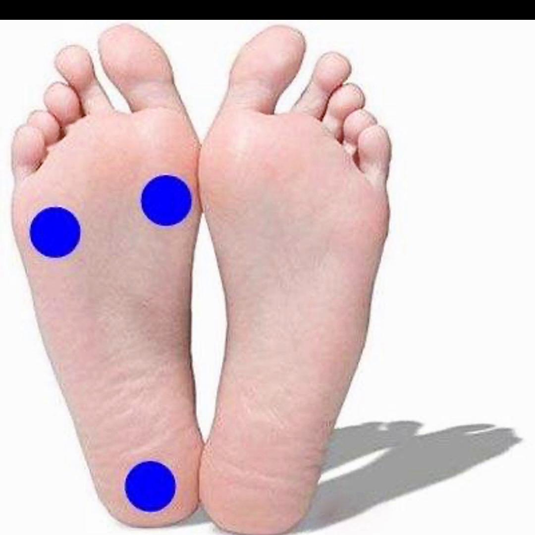 怎么练足弓还有矫正走路姿势,低足弓如何训练成高足弓