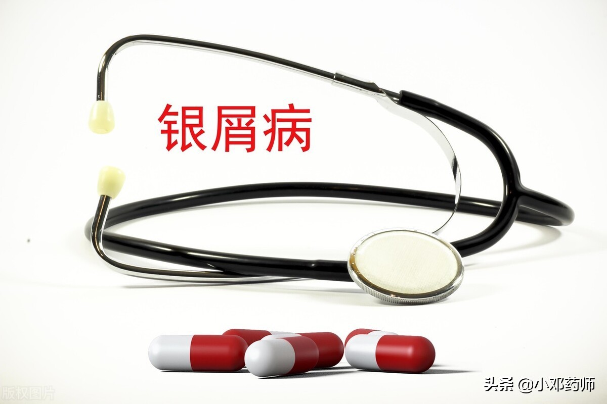 儿童银屑病擦他卡西醇会变红吗,面部银屑病能用他卡西醇