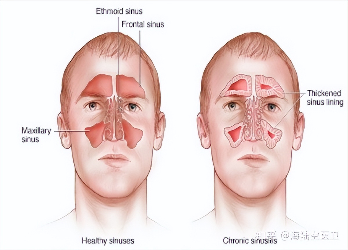 航空医疗急救转运,航空医疗急救常识