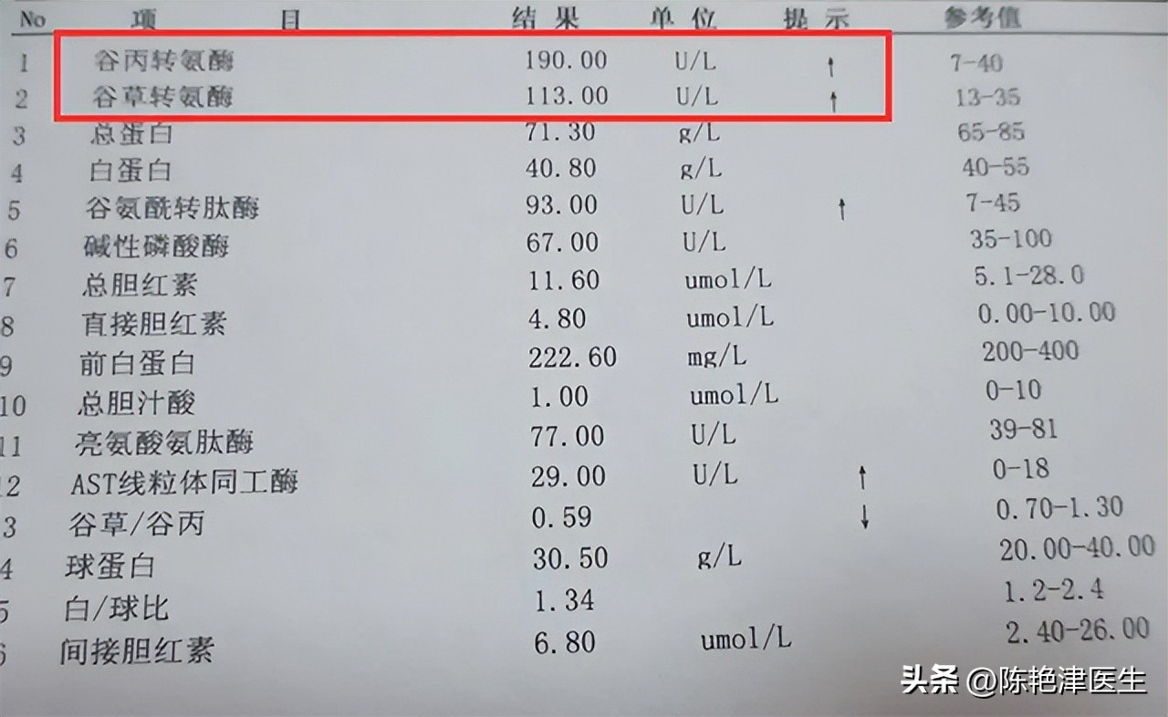 谷丙转氨酶和谷草转氨酶是什么,谷丙转氨酶高和谷草转氨酶高区别