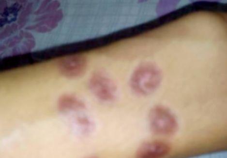 女孩被迫纹纹身,女人被迫纹身手术