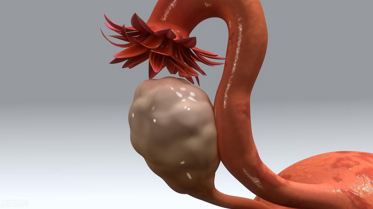 先天性宫颈口松弛是什么原因引起,女人宫颈口松弛是什么原因