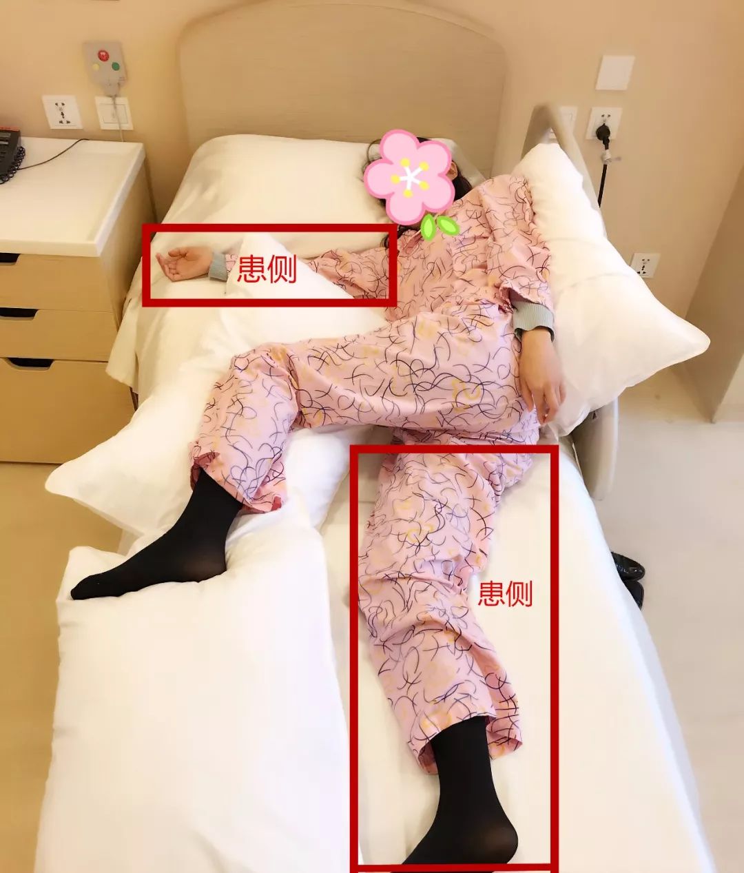 脑卒中恢复期的康复治疗,脑卒中患者的康复治疗方案