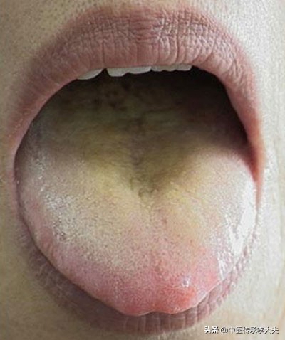 燥咳干咳无痰应用啥中药,黄痰浓稠干咳用什么中药