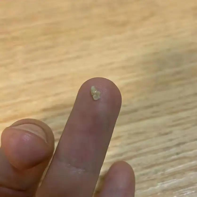 吐出黄色的苦东西咋回事,吐出了黄色绿色的苦水是什么