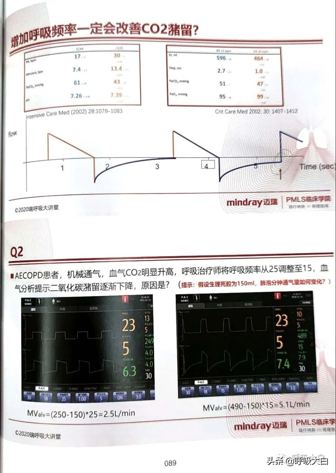 呼吸机epr怎么调节,呼吸机如何调节温度