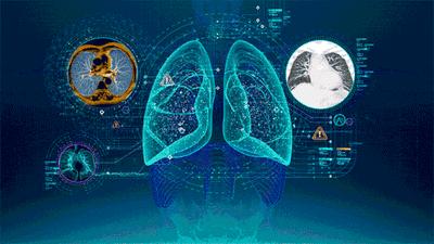 一查竟有两种癌,一查出来就是恶性肿瘤