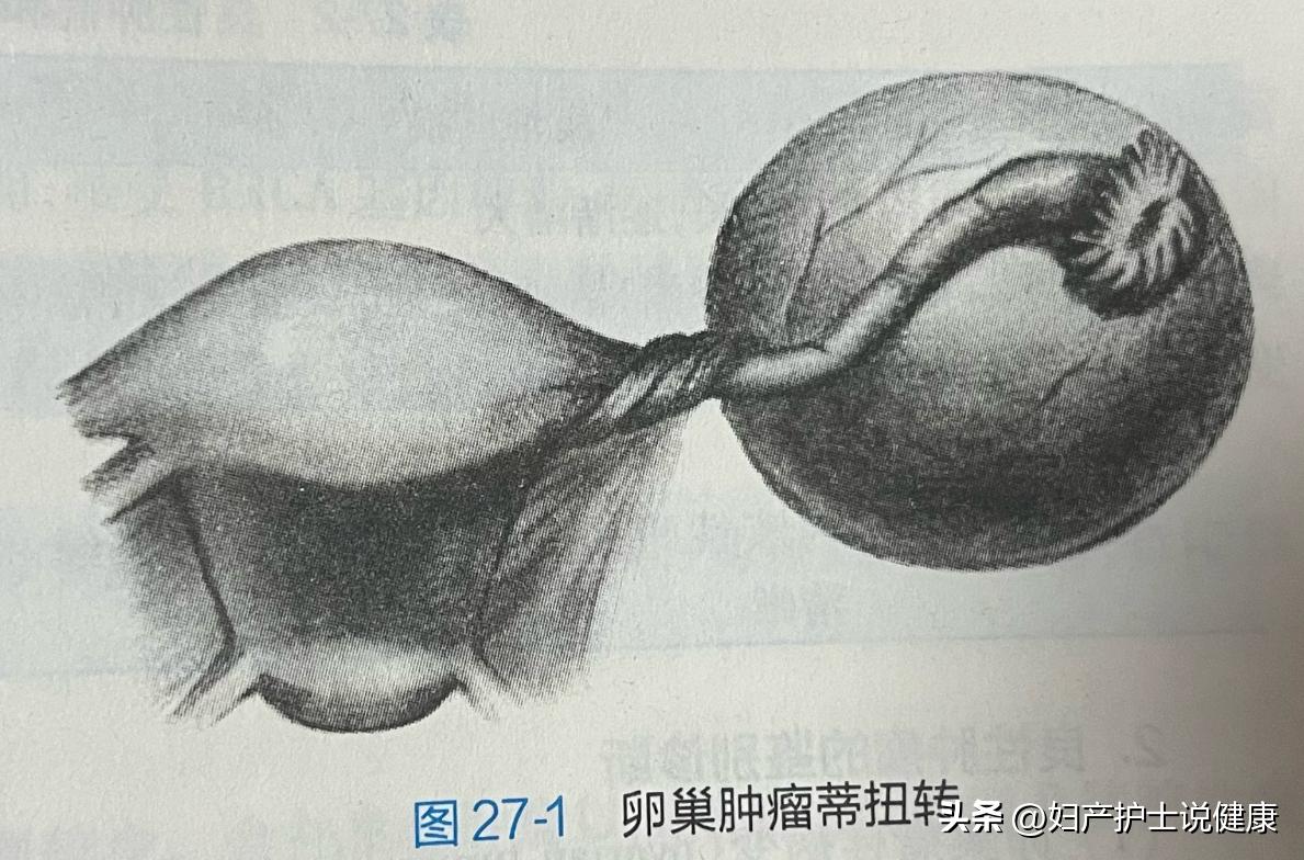 75岁老人腹胀肚子疼,82岁老太太肝硬化晚期突然肚子疼