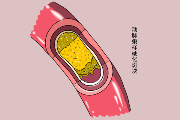 开始长老年斑是什么原因,长老年斑与身体健康有关系吗
