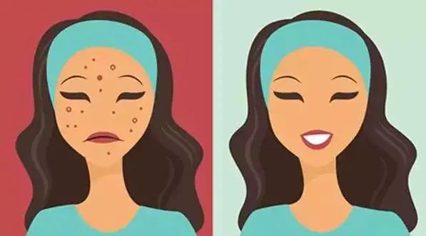 痘坑目前最好的处理方法,痘坑咋办呀