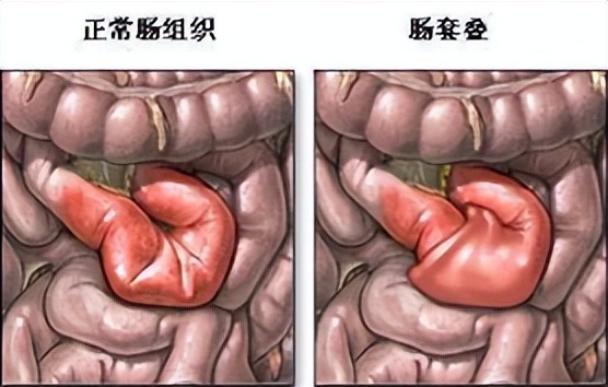 年轻男子突发肩疼,男子胸痛到医院检查突然抢救