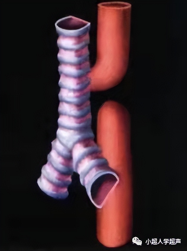 超声影像小视频,食道闭锁超声表现