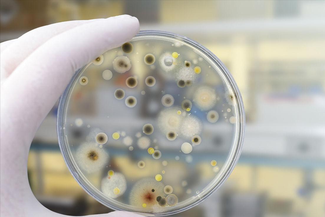 新西兰的几维鸟属于什么类型,新西兰的几维鸟有什么样的形态