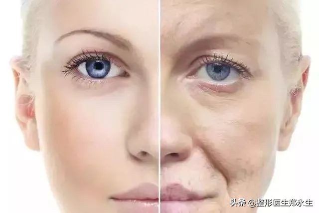 激光祛面部皱纹能保持多久,面部皱纹去除拉皮可以保持多久