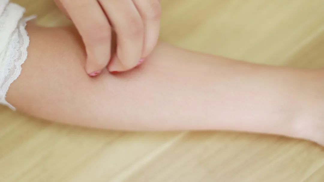 过敏性的皮炎皮疹是什么症状,化妆品过敏性皮炎症状怎么治疗