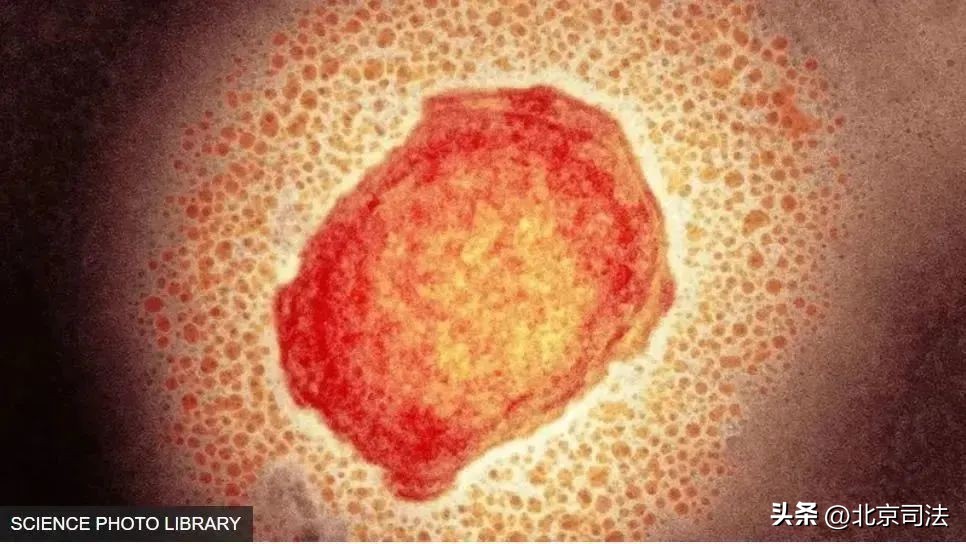 猴痘突发值得担心吗,猴痘应急预案和流程