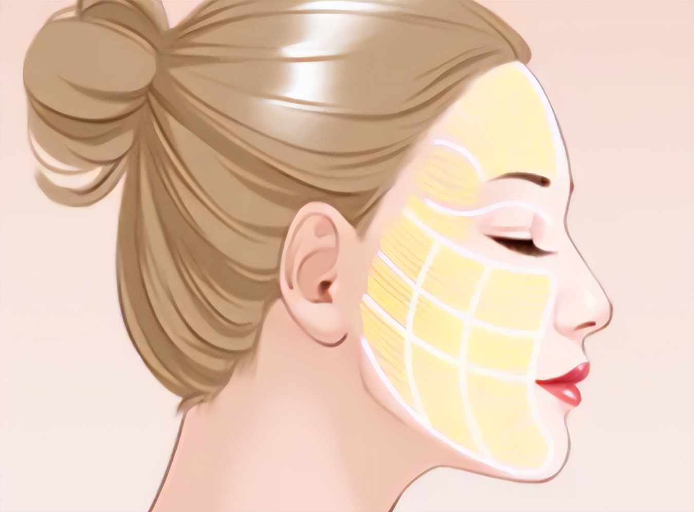 脂肪填面部后的注意事项,脂肪填充后皮肤会不会容易变红