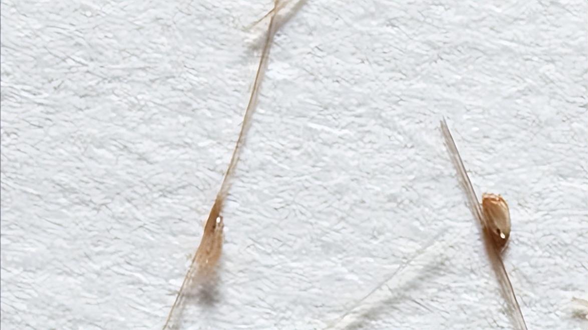 “*处私**”的毛有什么用？能剪吗？提醒：有2种情况，剪掉反而更好