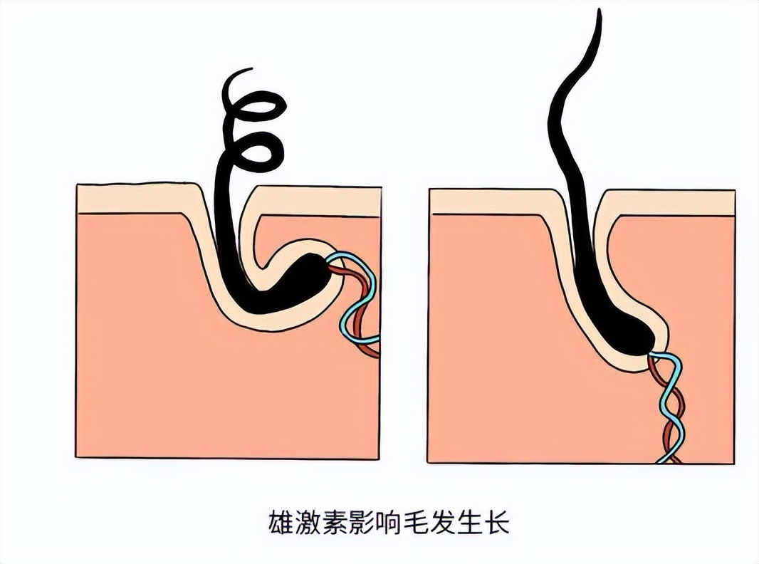 阴毛变白是身体生病了吗？