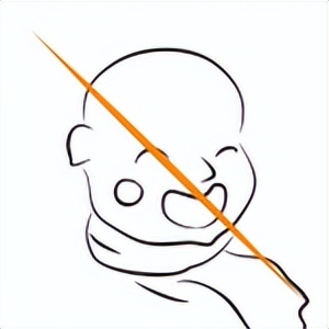 雌二醇用了会有什么副作用,雌二醇用量极限