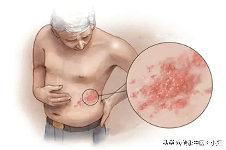 寒热舌诊图解大全,如何看舌象判断疾病准确用药