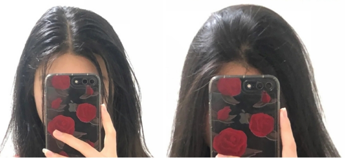 孕期洗发水去屑止痒的推荐,孕期洗发水红榜推荐